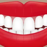 Teeth Whitener - Photo Editor